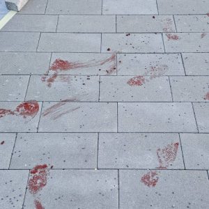 Запрљан дио новог шеталишта: Трим стаза још увијек није у употреби, апел суграђанима да чувамо заједничку имовину Запрљан дио новог шеталишта: Трим стаза још увијек није у употреби, апел суграђанима да чувамо заједничку имовину