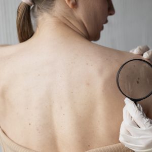 Одржана Регионална конференција пацијената обољелих од меланома, присуствовали и представници Града